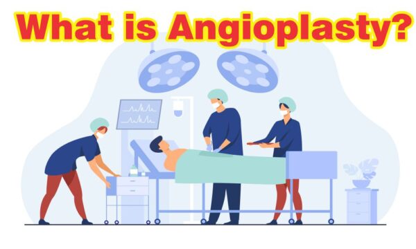 Angioplasty